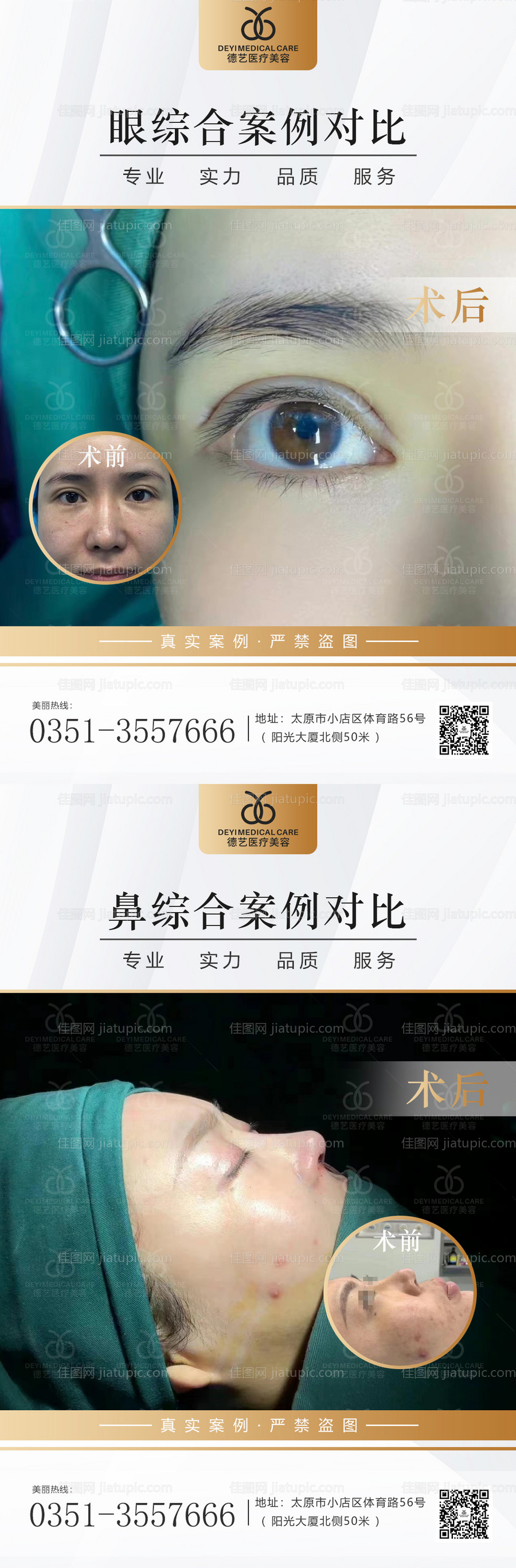 医美案例对比图-源文件
